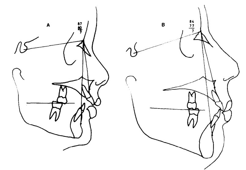 Bước vẽ đề 2 được áp dụng trong ôn thi và giảng dạy các môn vẽ đồ thị, kiến trúc, thiết kế... Hãy xem ảnh liên quan để nắm rõ các bước cần thực hiện và có thể áp dụng cho phần bài tập của bạn.