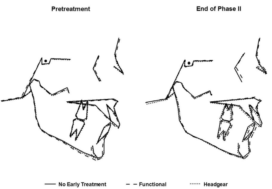 Hình 2: Mô tả chồng hình của 3 nhóm trước điều trị và kết thúc điều trị ở giai đoạn 2
